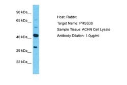 PRSS38 Rabbit anti-Human, Polyclonal, Novus Biologicals 0.1 mL | Buy Online | Novus Biologicals | Fisher Scientific